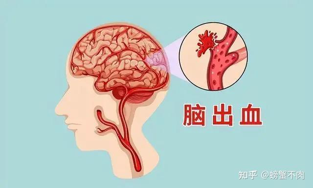 高血压的危害你注意了吗？